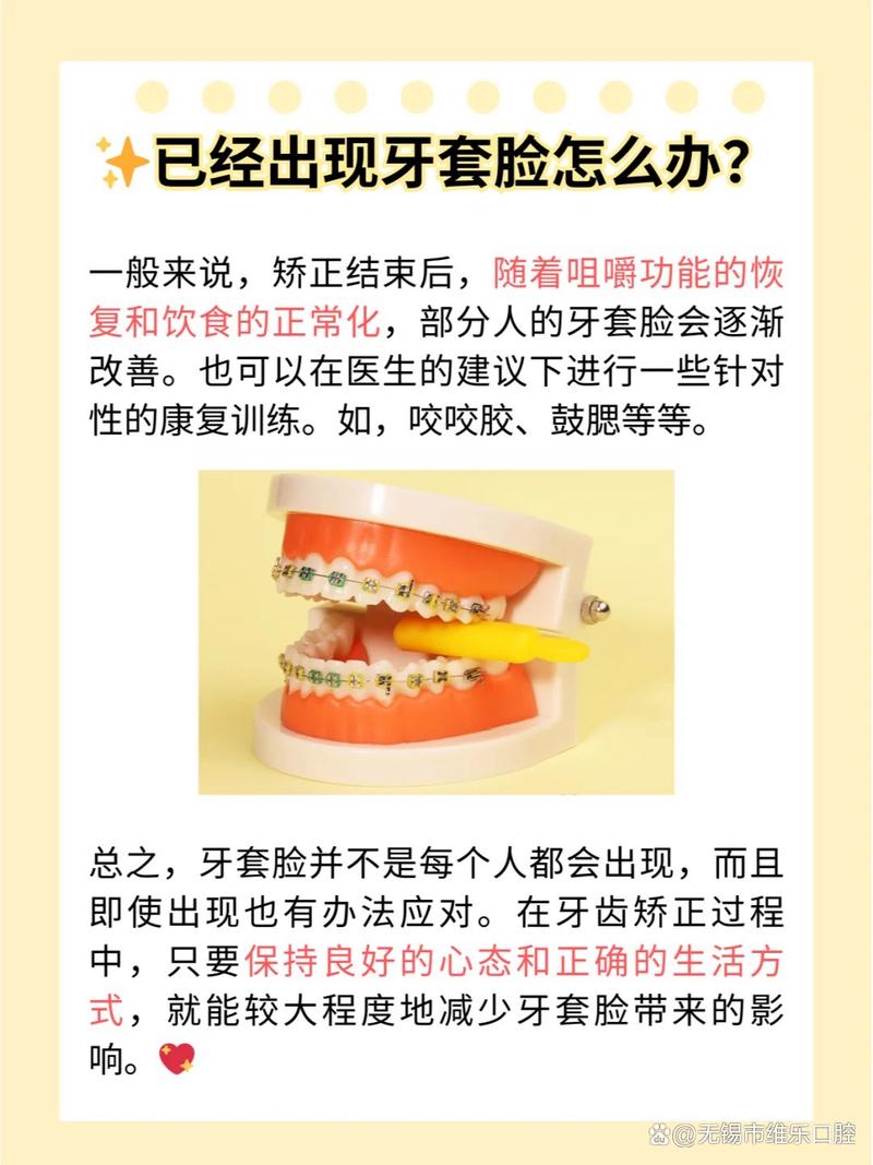 戴牙套是什么原理