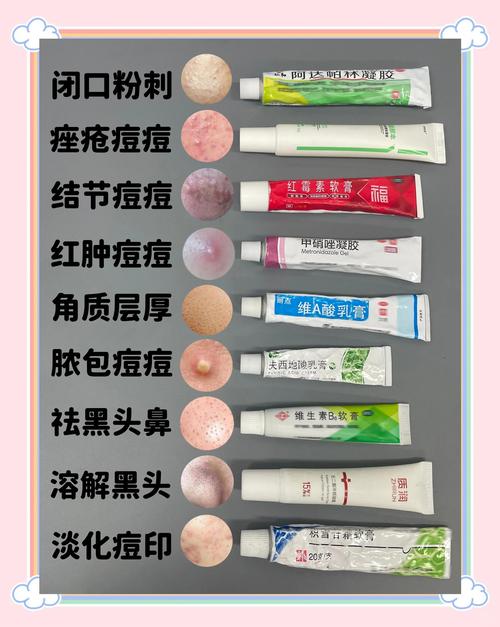 脸上长痘抹什么药膏