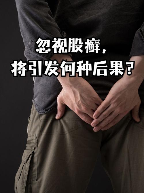 股癣看什么科