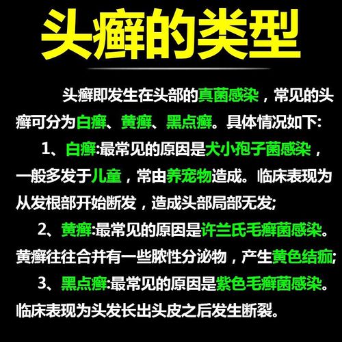股癣看什么科