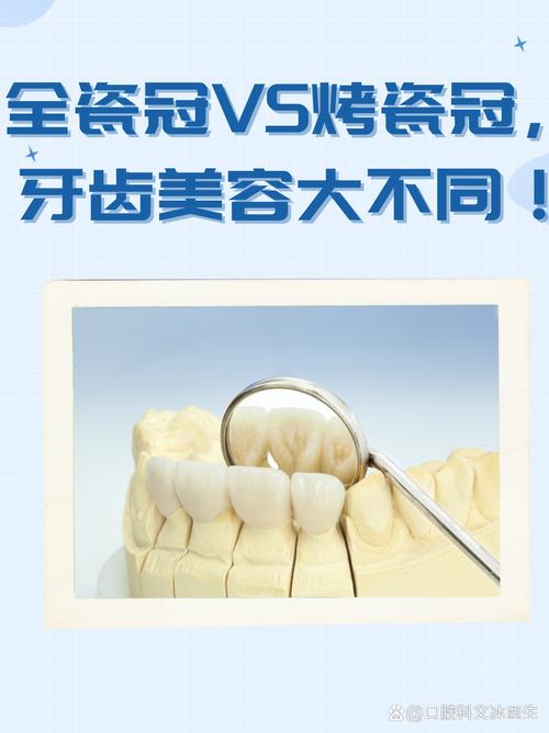 什么是美容冠
