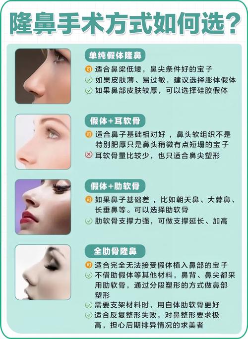 隆鼻注意什么