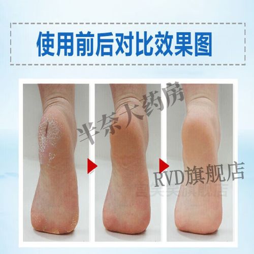 肤念什么