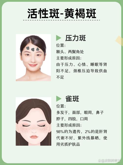 为什么脸上容易长斑