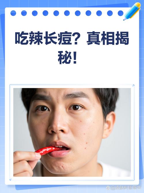 为什么吃辣椒会长痘