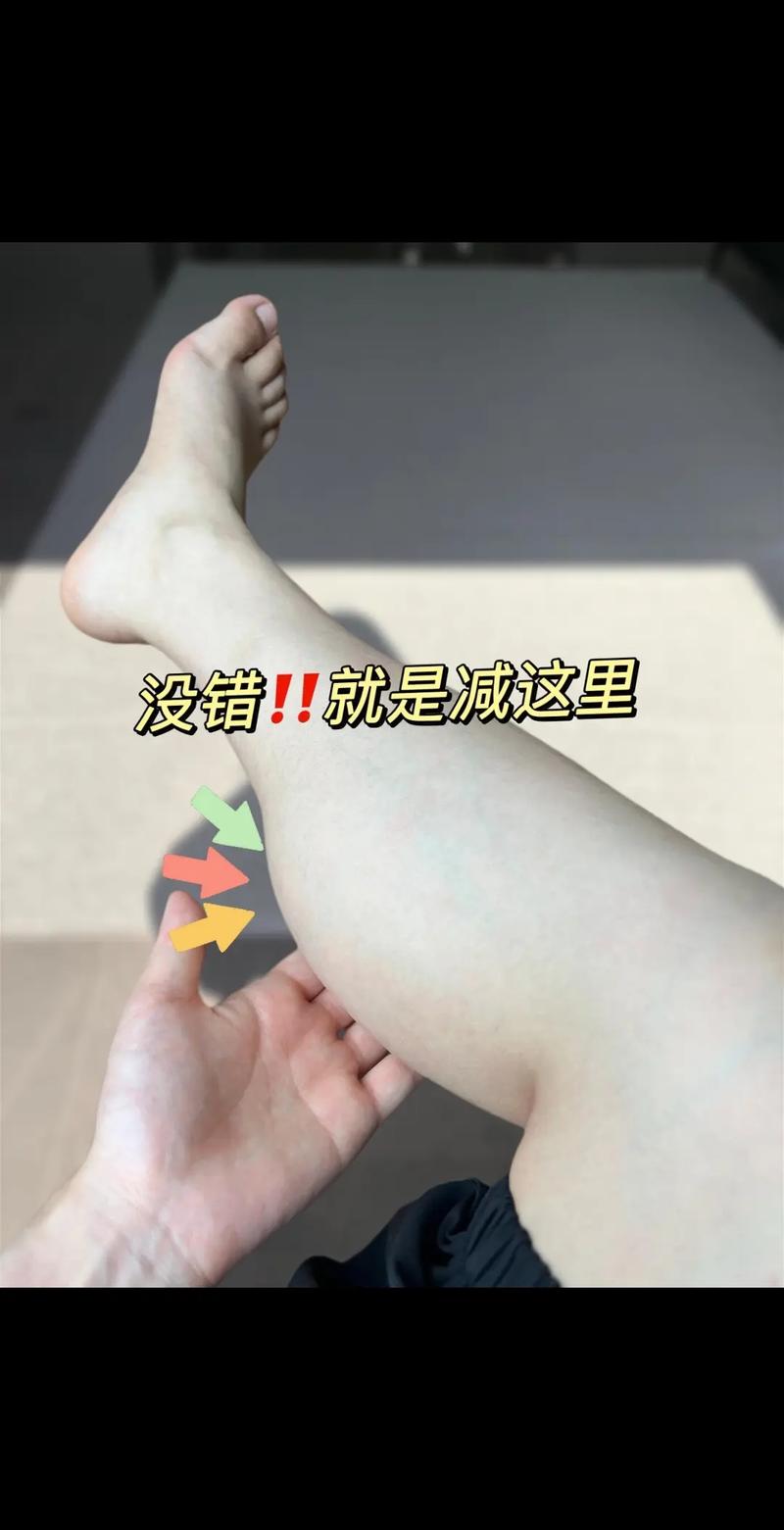 为什么腿部减肥会粗肿