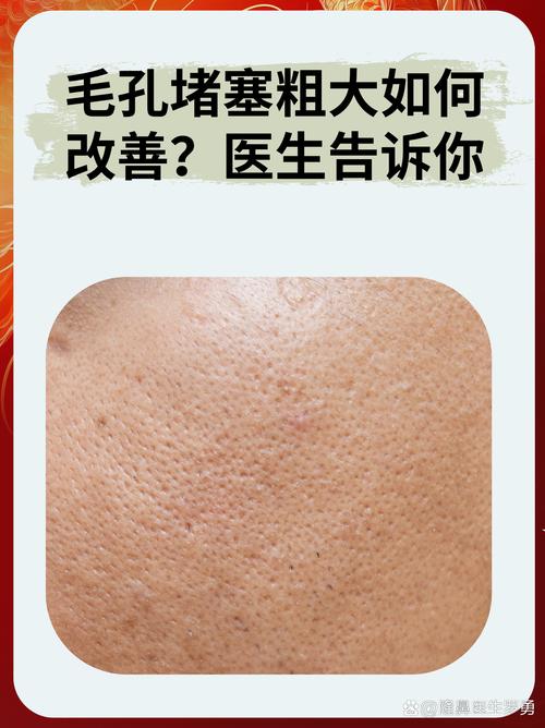 什么是毛孔堵塞