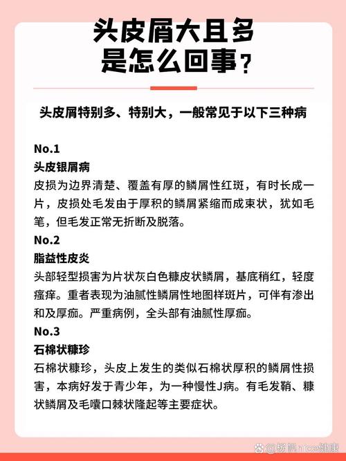 头皮屑多是什么病