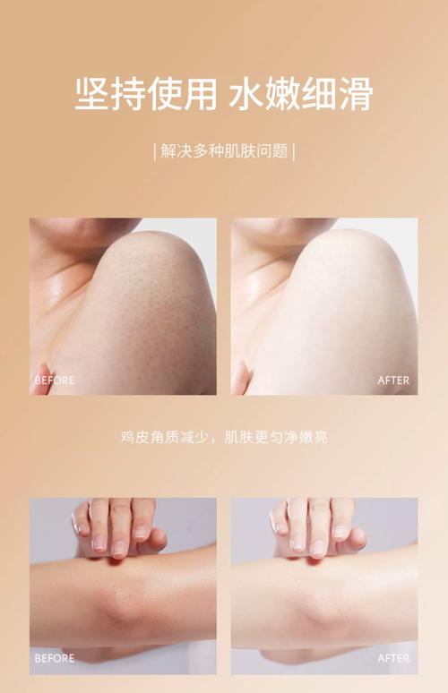 减肥霜对皮肤有什么伤害