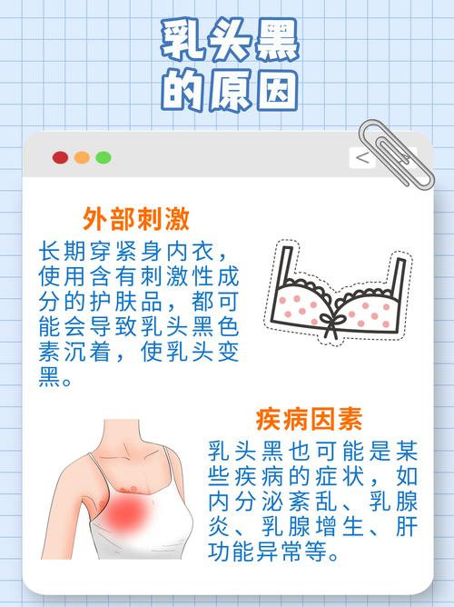 奶头黑是什么原因
