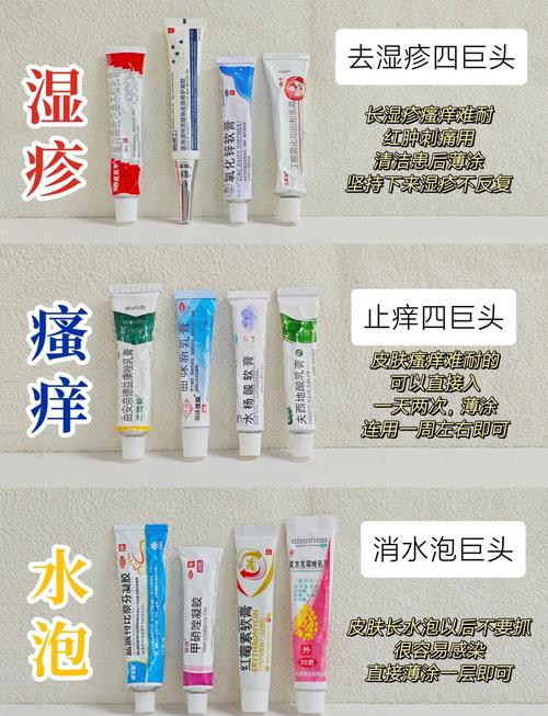 湿疹应该挂什么科