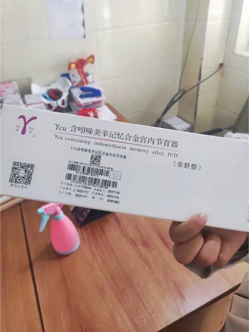 上环需要准备什么
