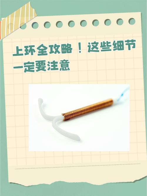上环需要准备什么