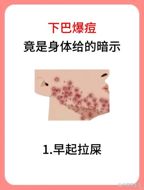 嘴边长痘痘什么原因