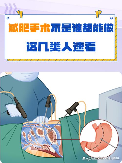 做什么手术减肥