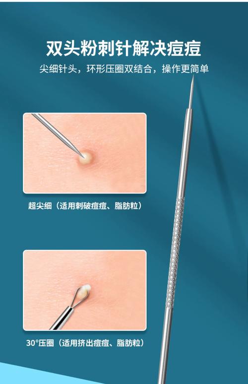 粉刺针用什么消毒