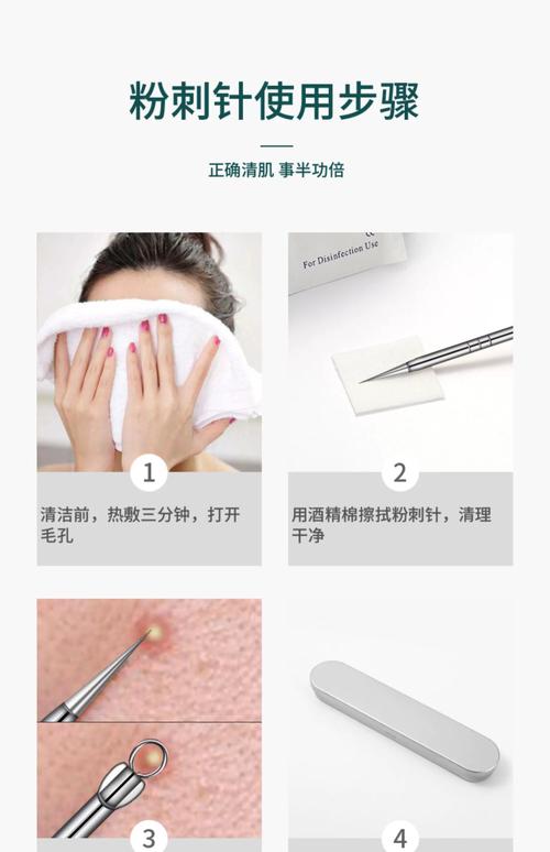 粉刺针用什么消毒