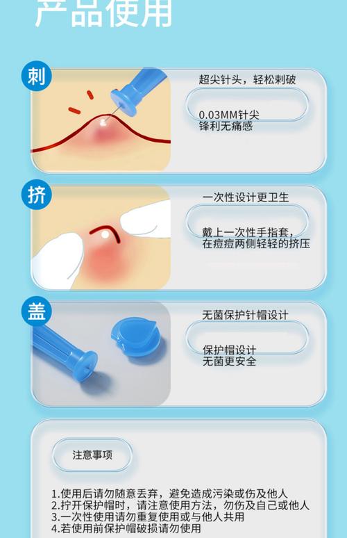 粉刺针用什么消毒