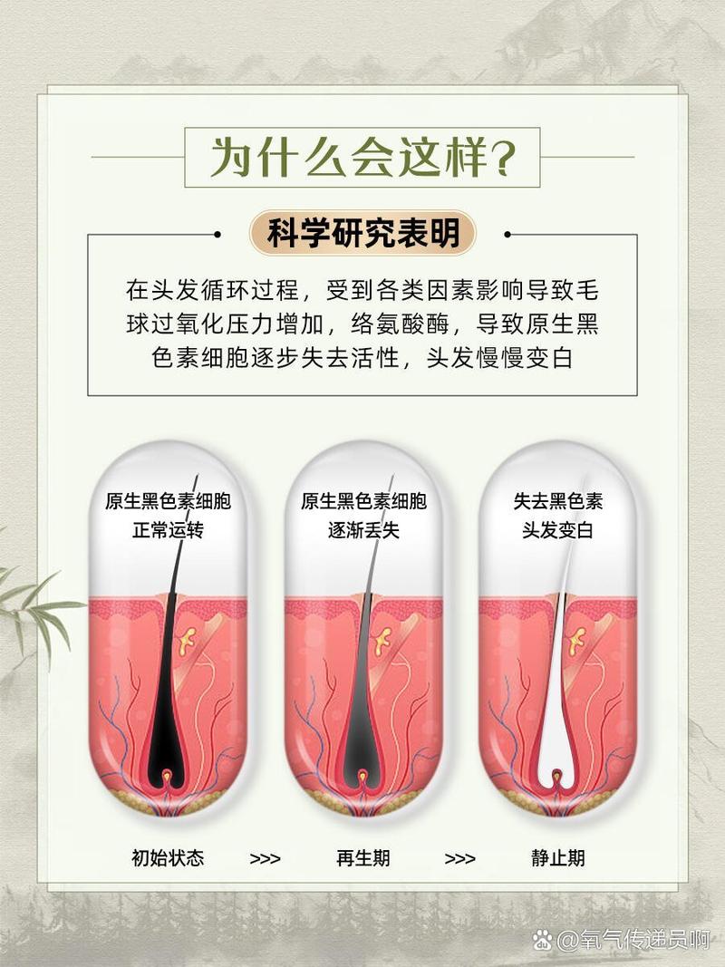 为什么突然长白头发