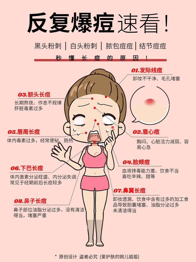 总长痘痘是什么原因