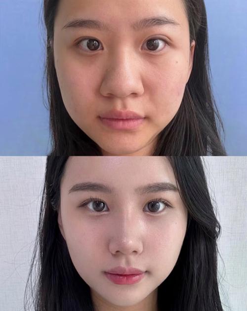 扁鼻子适合什么发型