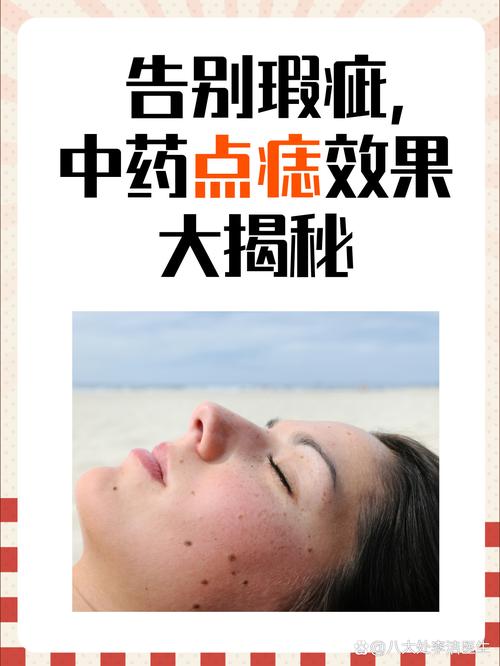 点痣用什么好