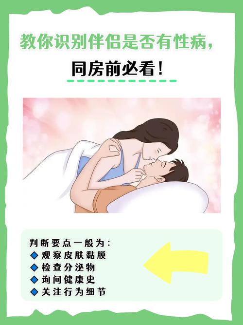 什么是性伴侣