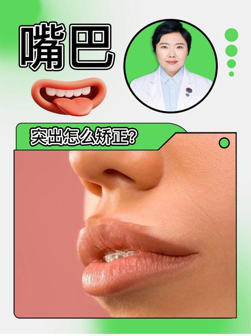 为什么会有龅牙