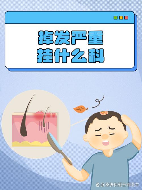 掉发什么科
