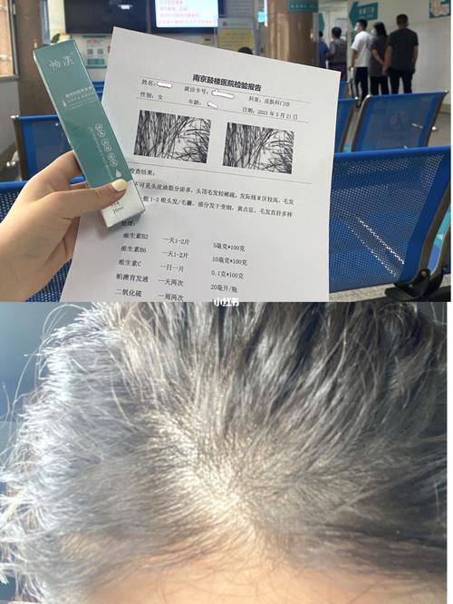 掉发什么科