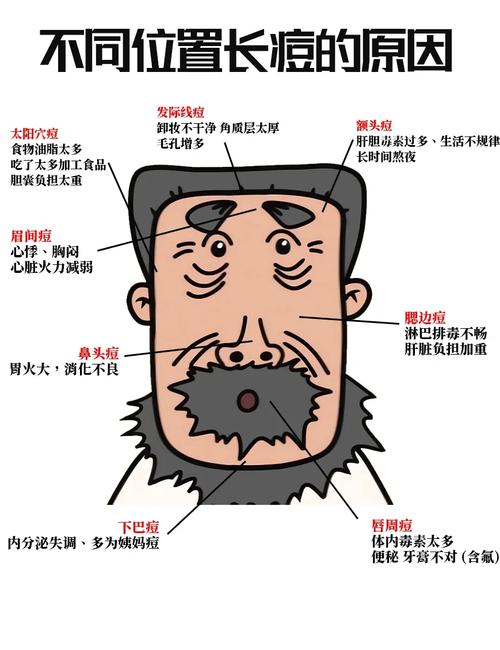 太阳穴长痘是什么