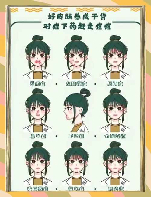 脸颊长痘因为什么
