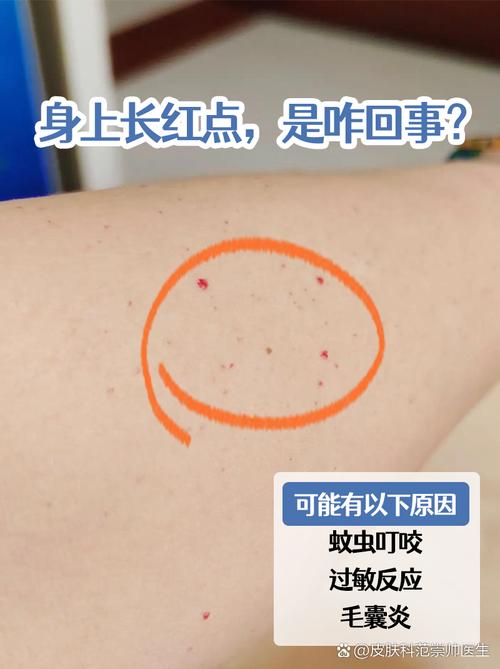 皮肤上的红点是什么