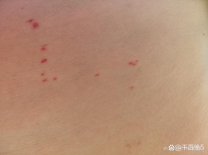 皮肤上的红点是什么