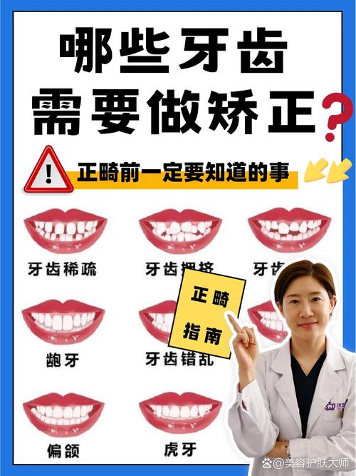 牙齿矫正有什么好处
