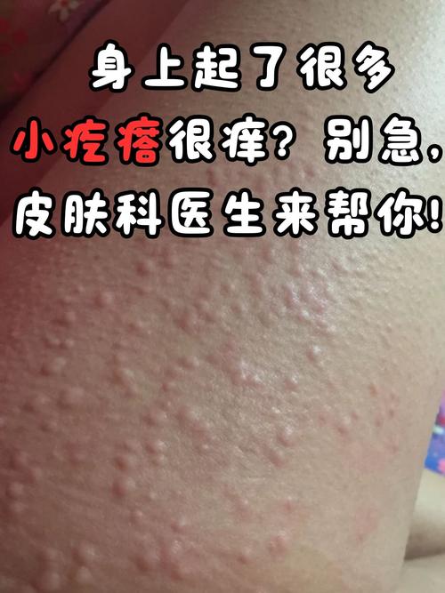 全身瘙痒什么原因