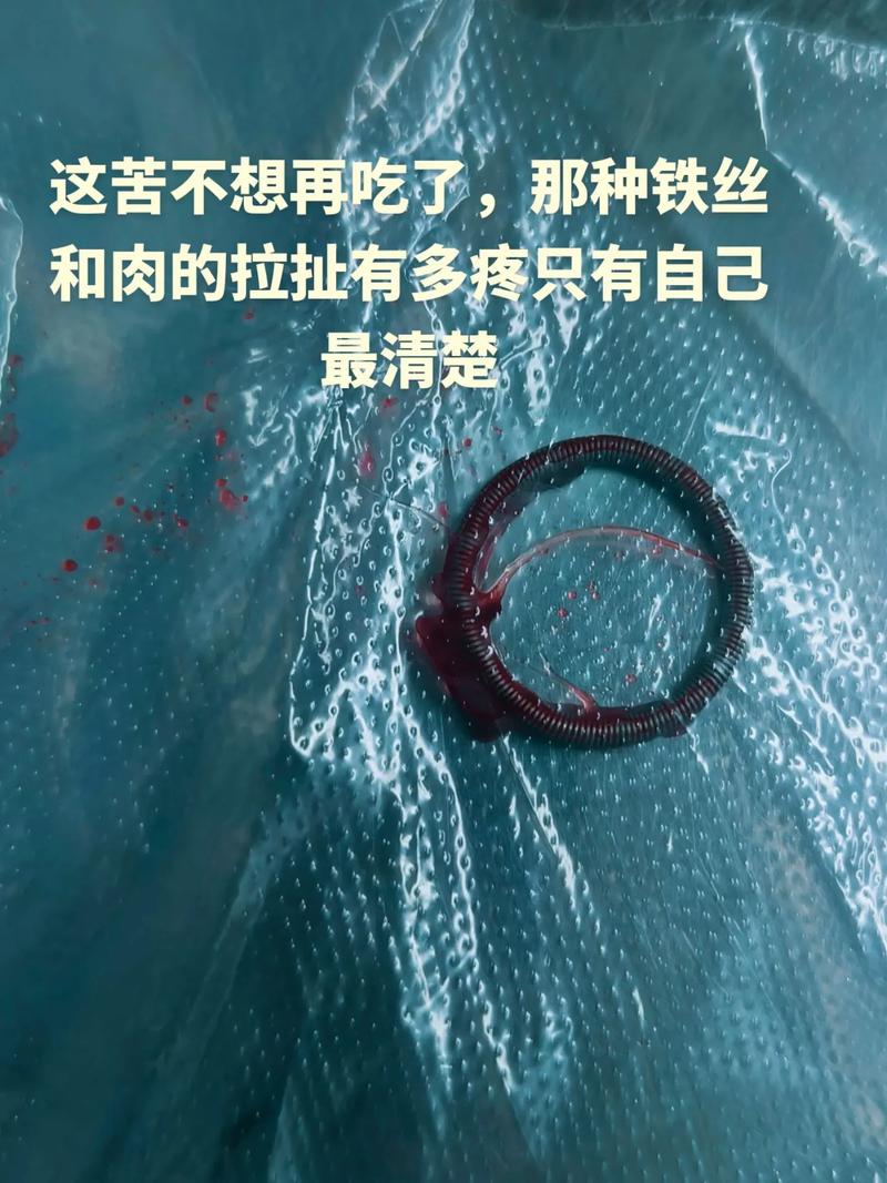 上环不能吃什么