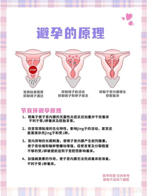 上环不能吃什么