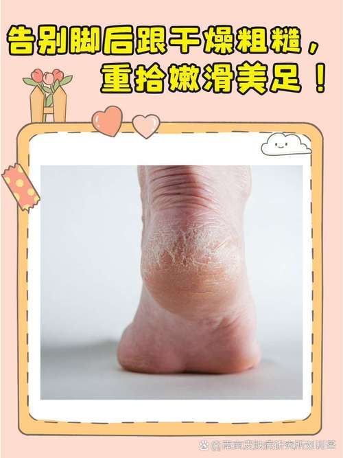 脚干为什么