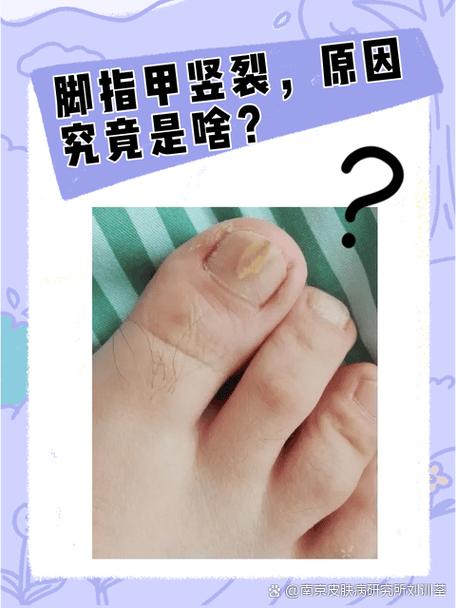 脚干为什么
