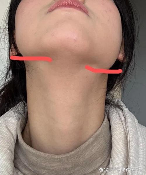 为什么两边脸不对称