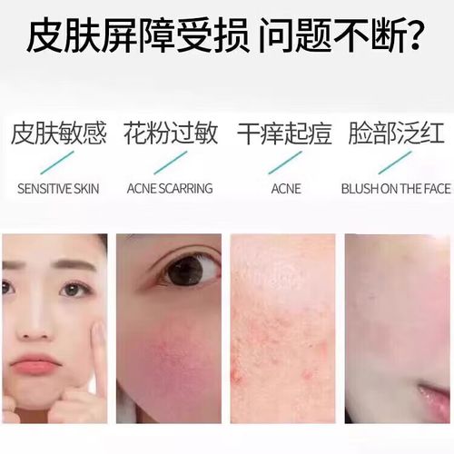 角质层薄用什么面膜