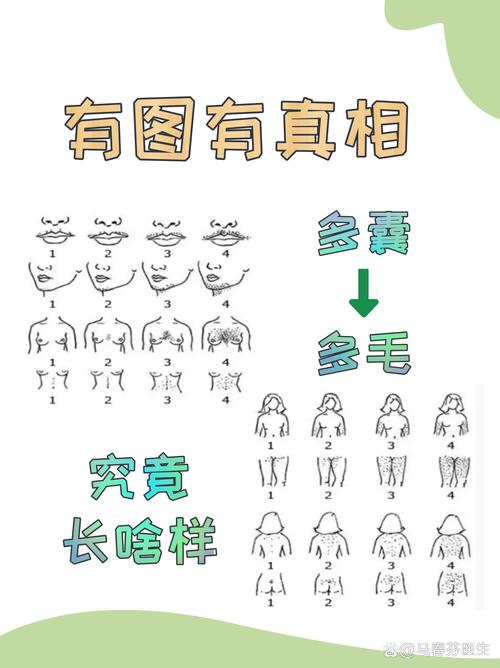 毛太多是什么原因