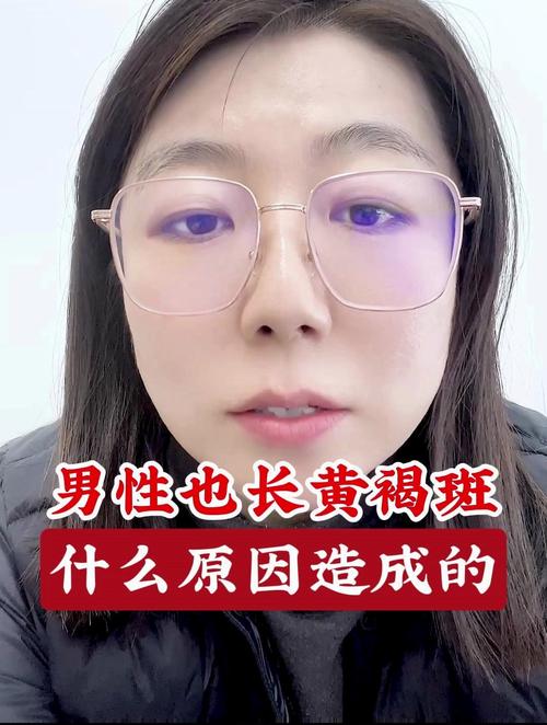 男人长斑是什么原因