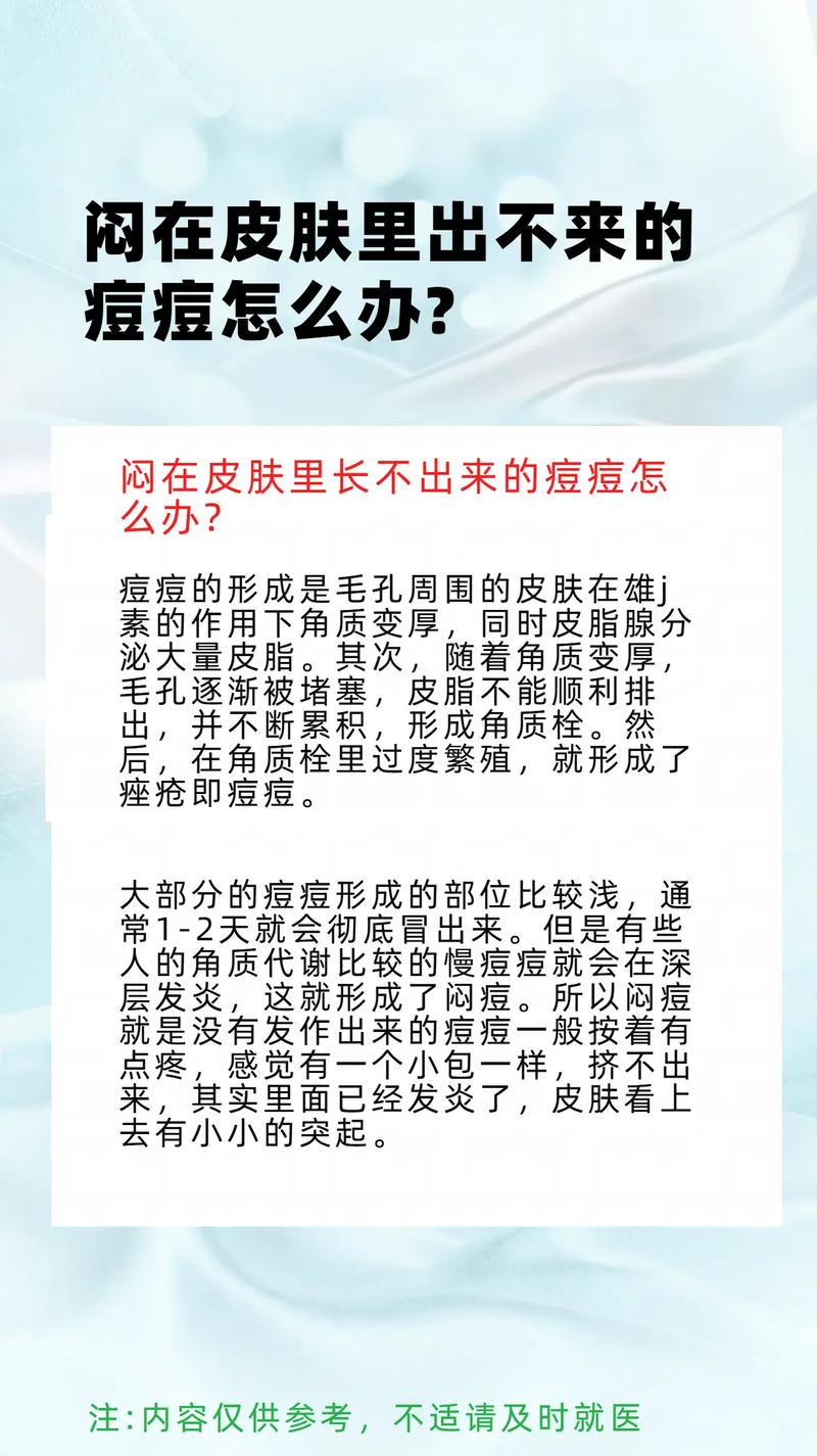 闷痘是什么意思