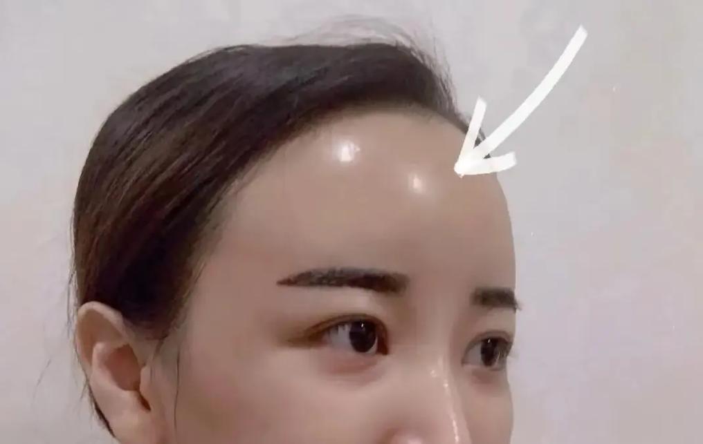 额头高是什么意思