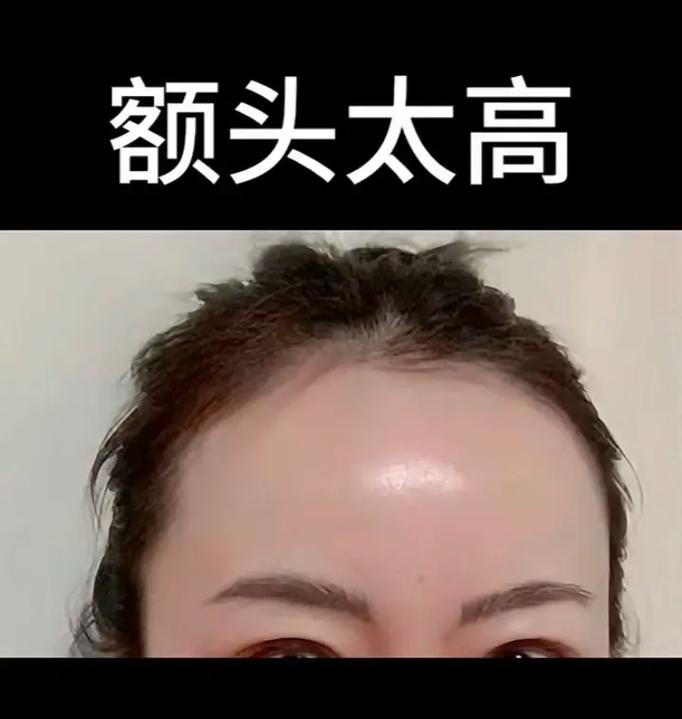 额头高是什么意思