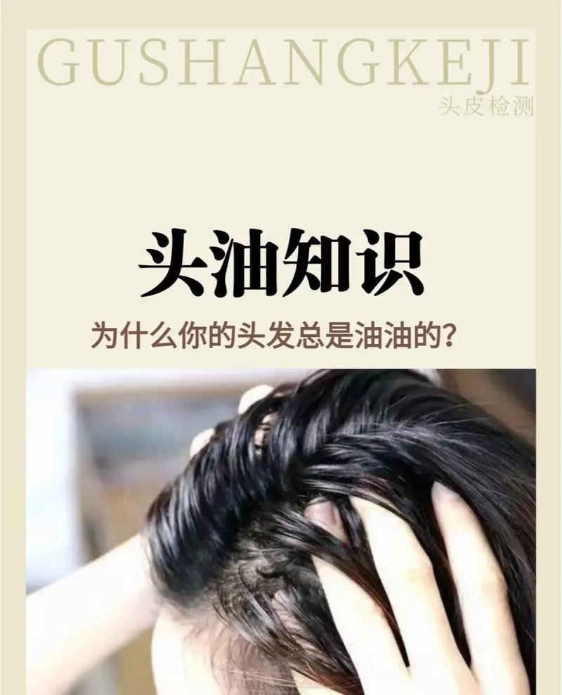 头皮出油什么原因