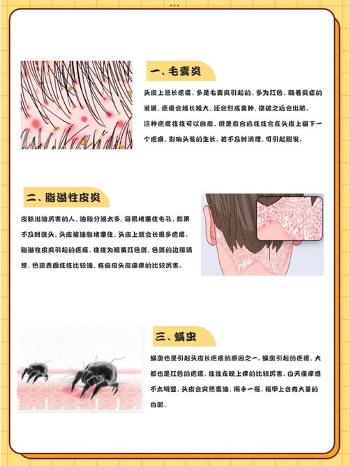 头皮出油什么原因