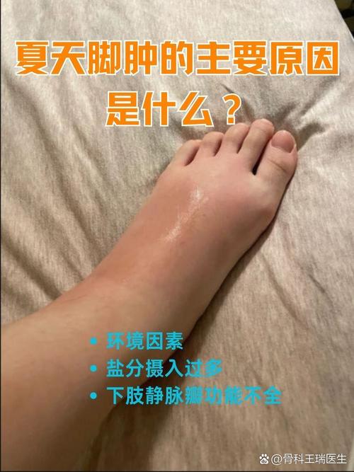 左脚浮肿是什么原因